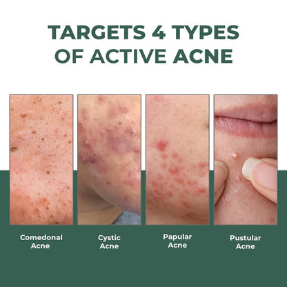 Acne Spot Corrector Gel Serum