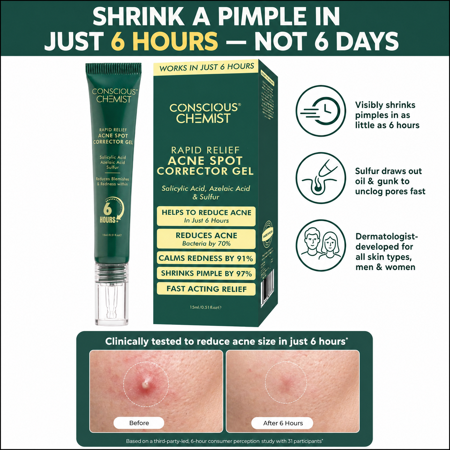 Acne Spot Removal Cream
