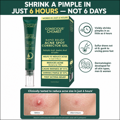 Acne Spot Removal Cream
